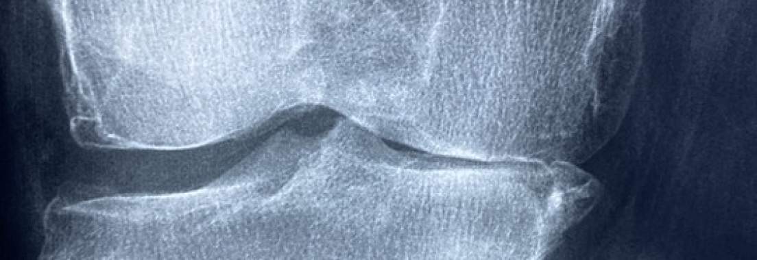 North County Orthopedic Medical Group